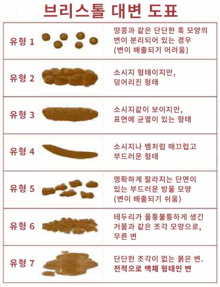 브리스톨 대변 도표