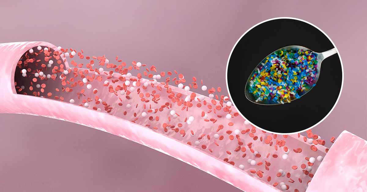 인간 혈액에서 처음으로 미세 플라스틱이 발견되었습니다
