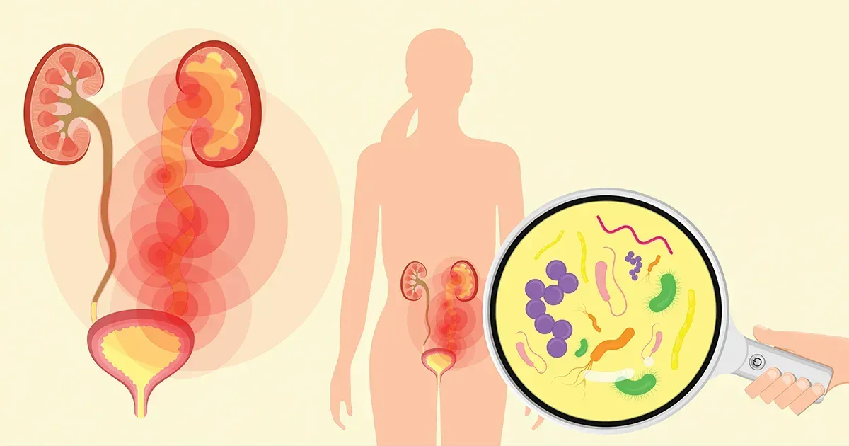 요로 감염의 주요 원인과 잠재적 합병증은 무엇일까요?