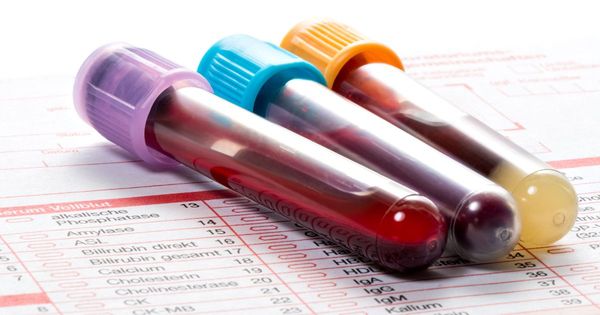 정기적인 혈액 검사에서 무엇을 테스트하는 것이 좋을까요?