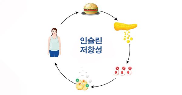 인슐린 저항성과 질환 가속화 사이의 연관성