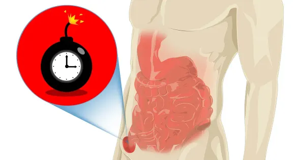 서혜부 탈장을 극복하고 활력을 되찾는 방법