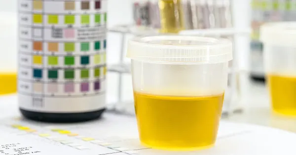 소변 냄새가 건강에 대해 말해주는 사실