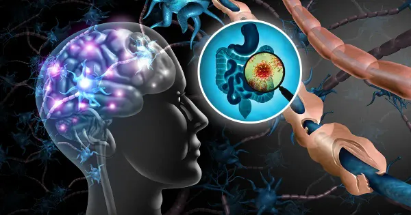 장내 미생물 불균형과 다발성 경화증의 연관성